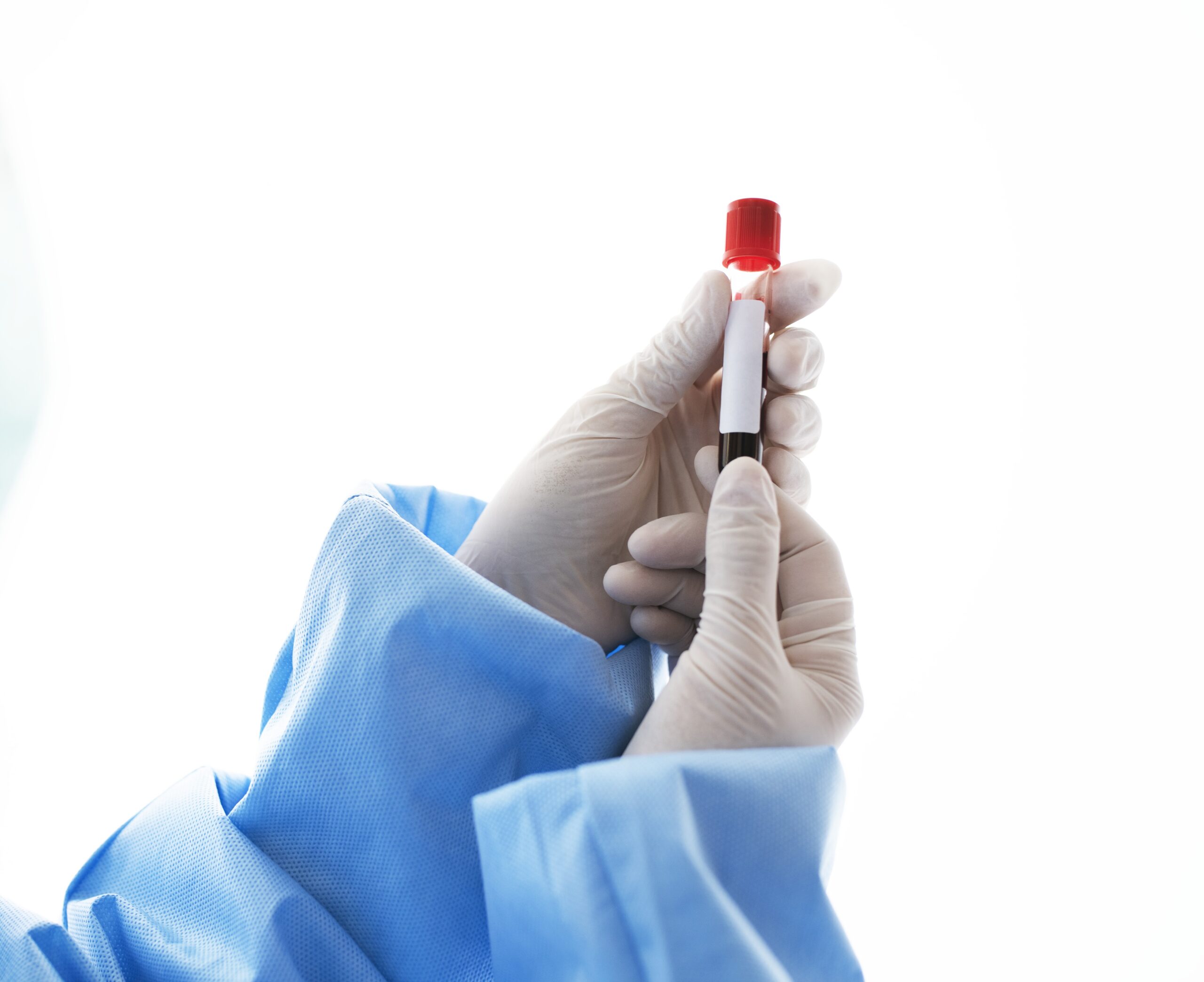 Blood test Blood test