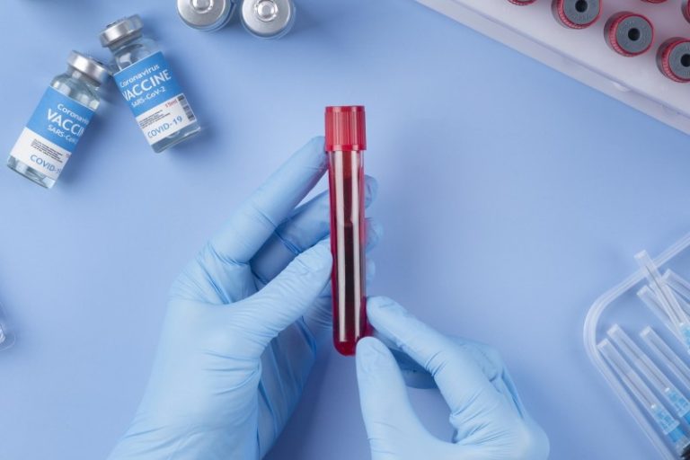 When to consider a Testosterone Test